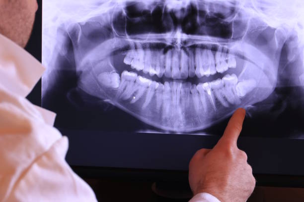 Best Broken or Cracked Tooth Emergency Dentist in Manistique, MI